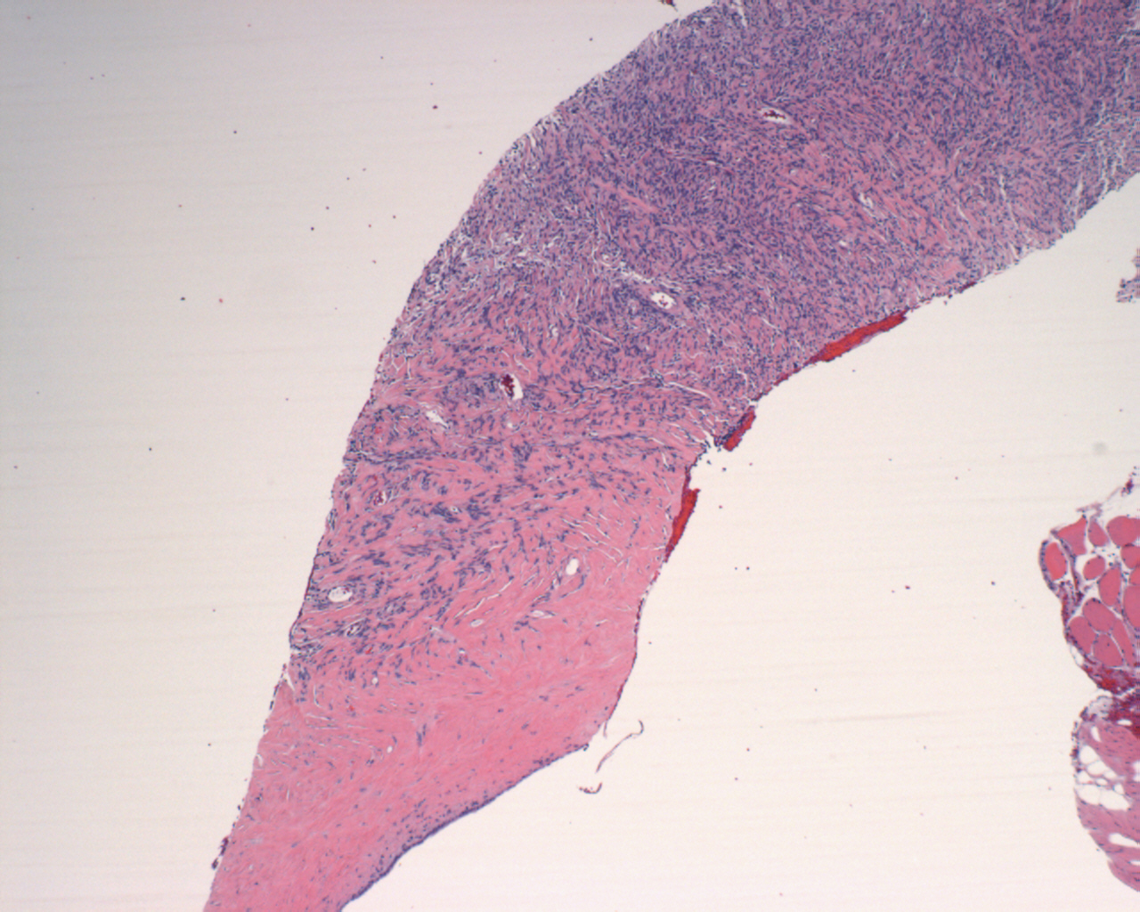 Pathology Image
